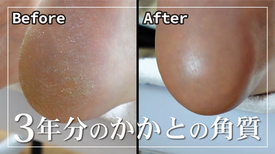 【一生取れる角質】フットケアでつるつるになりました！(後編)[角質除去][フットマッサージ][ネイルケア]