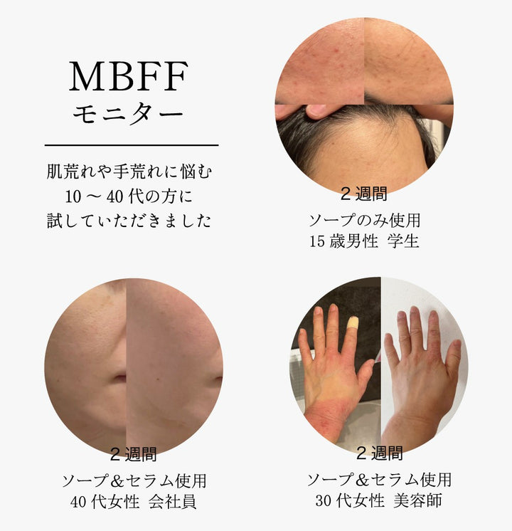 MBFF マムフローラセラム & ソイフローラソープ MBFFソイフローラソープPro 60g – DD